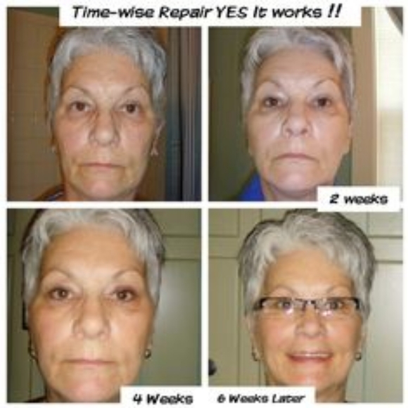 FREE Sonic w/ TimeWise Repair Ultimate Set 7 piece - Picture 2 of 12